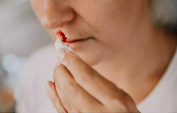 बार-बार नाक से खून बहता तो हो सकता हीमोफीलिया