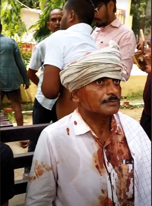 जमीन विवाद को लेकर दबंगों ने किया हमला, एक परिवार के 8 सदस्य घायल