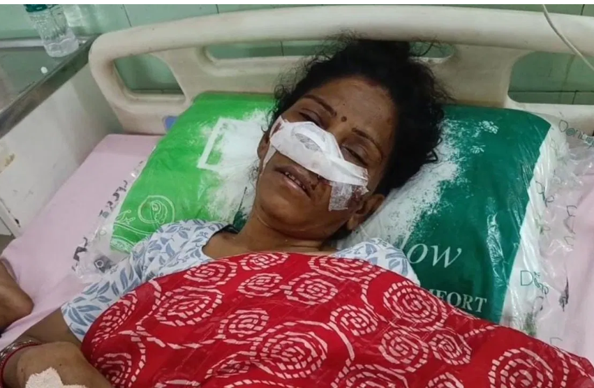ताजमहल के गुंबद से टपक रहा पानी! 73 मीटर की ऊंचाई पर क्यों हो रहा रिसाव, जानिए संभावित वजहें
